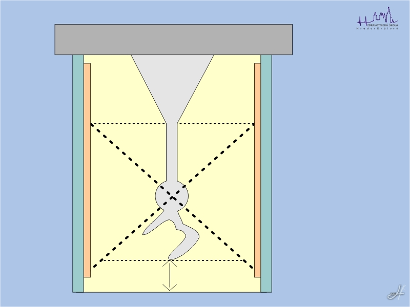 Licí forma se správným umístěním zásobníku v teplotním centru formy a modelu náhrady mimo něho